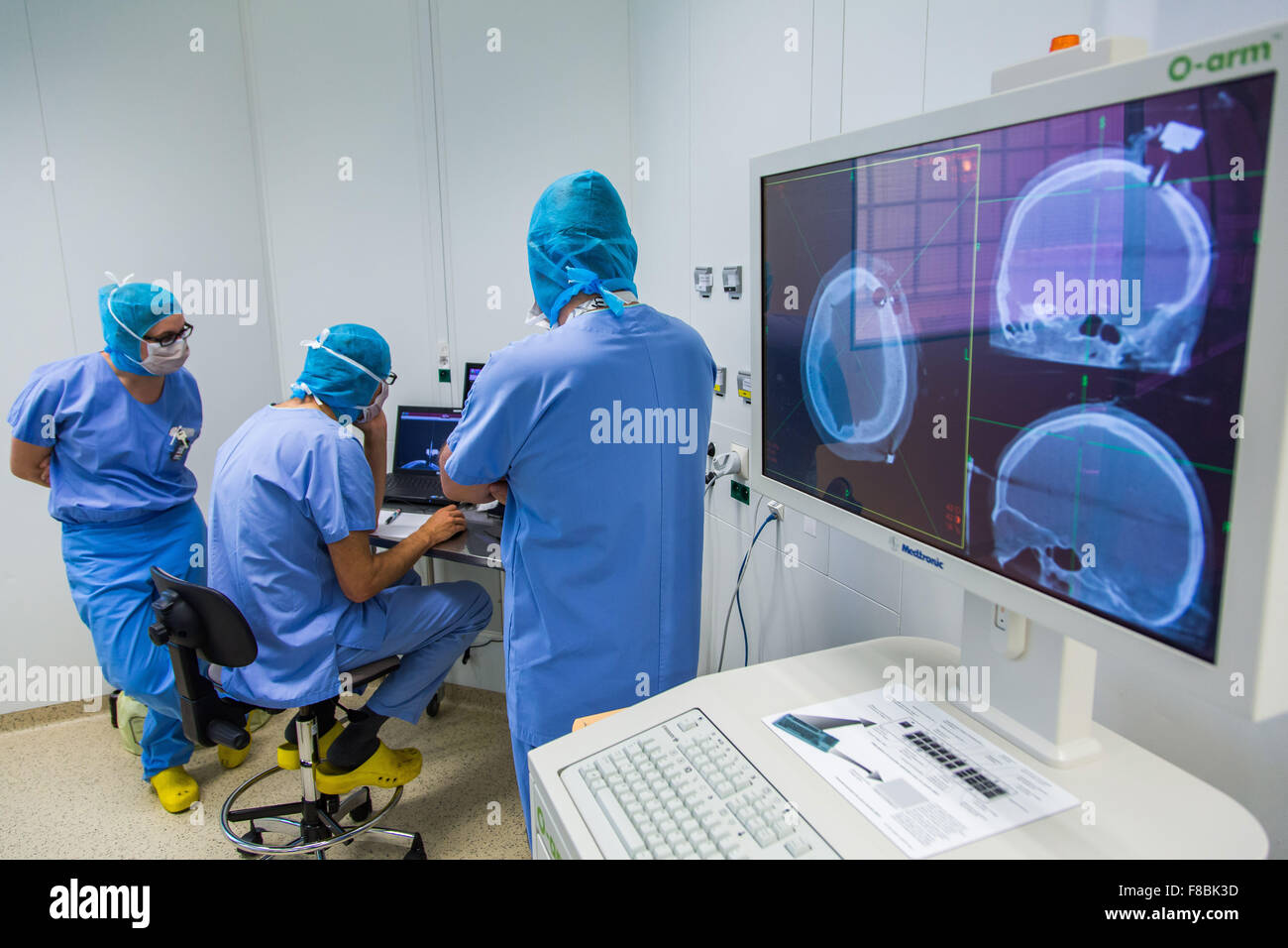 Il trattamento chirurgico del morbo di Parkinson da profonda stimolazione cerebrale con Rosa ® robot, ospedale di Amiens, Francia. Foto Stock