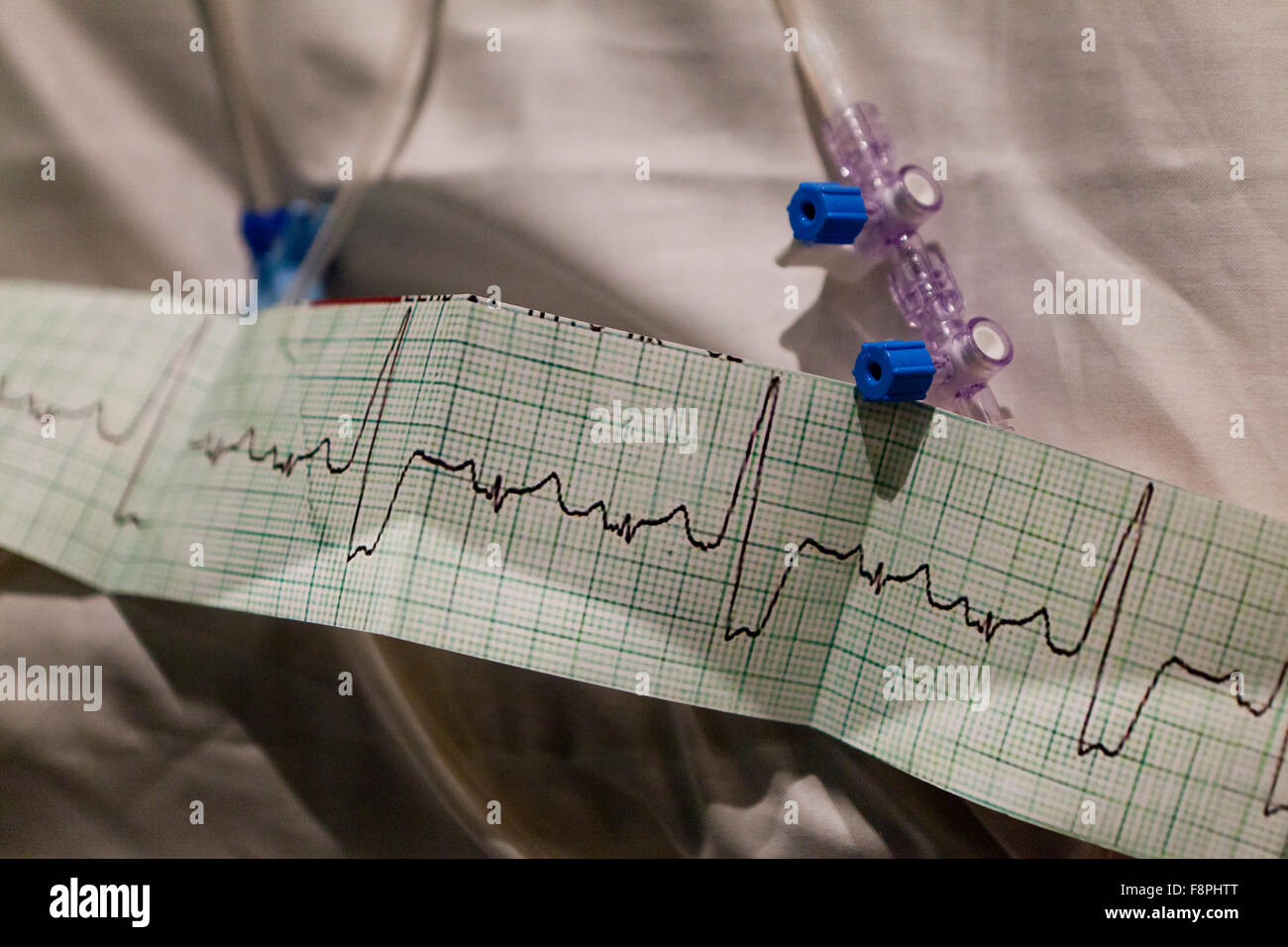 Monitor frequenza cardiaca il nastro sulla stampa medica fuori del nastro - USA Foto Stock