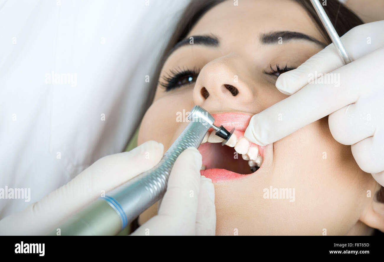 Giovani donne per il dentista nel riunito dentale si siede accanto a un medico per fare il dentista per vedere se i suoi denti erano in buone condizioni Foto Stock