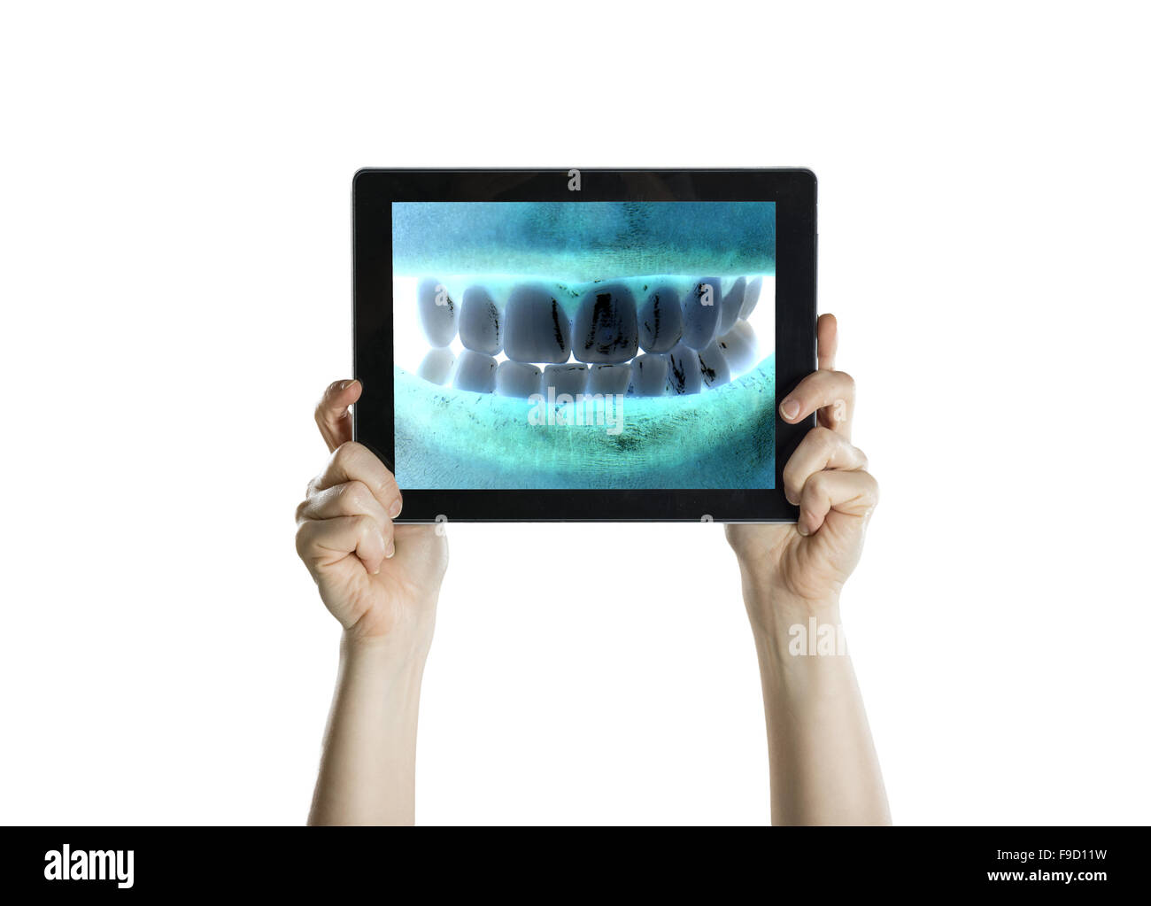 Dental closeup con schermo tablet, isolato su bianco Foto Stock