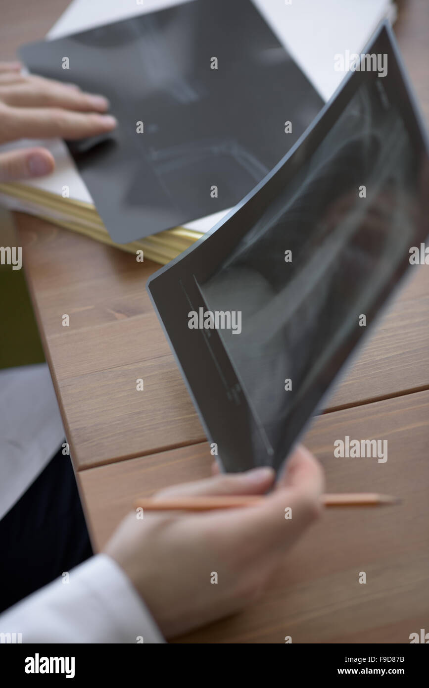 Le mani del medico tenendo il petto e polmoni xray in ufficio medico Foto Stock