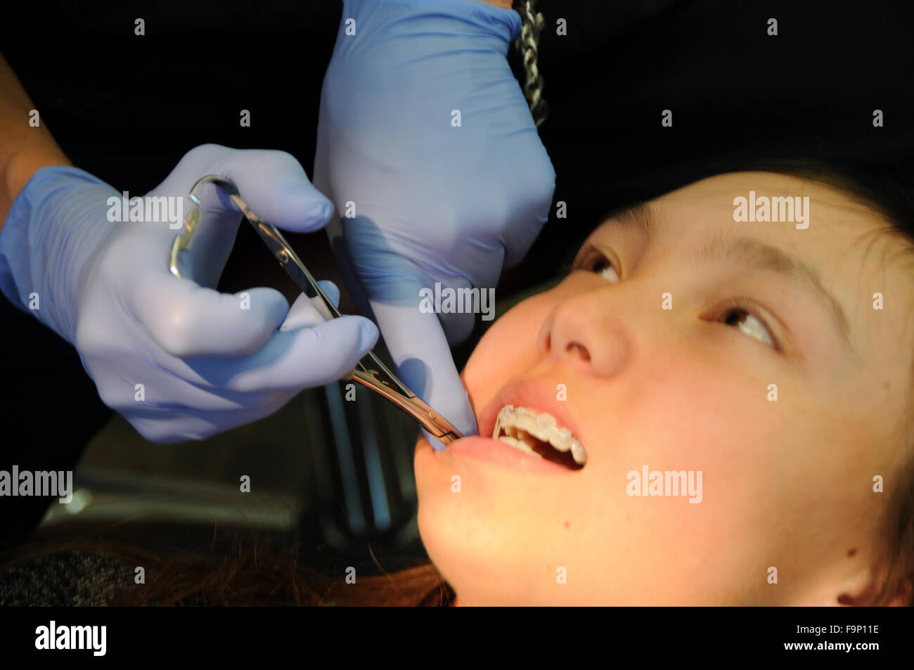 Un ortodontista è un tipo di dentista specializzato di raddrizzare i denti storti. Bretelle di regolazione e controllo denti & Bite. Foto Stock