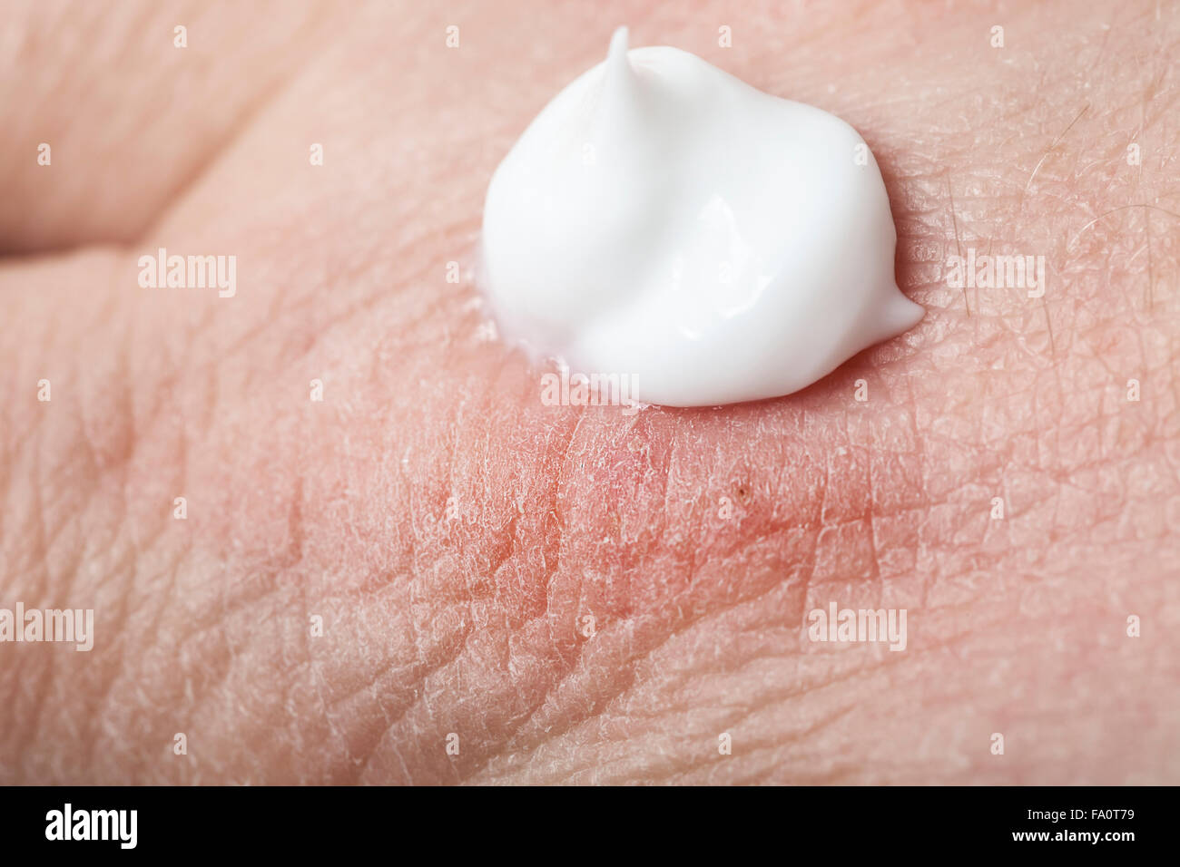 Crema idratante sulla pelle asciutta a portata di mano Foto Stock