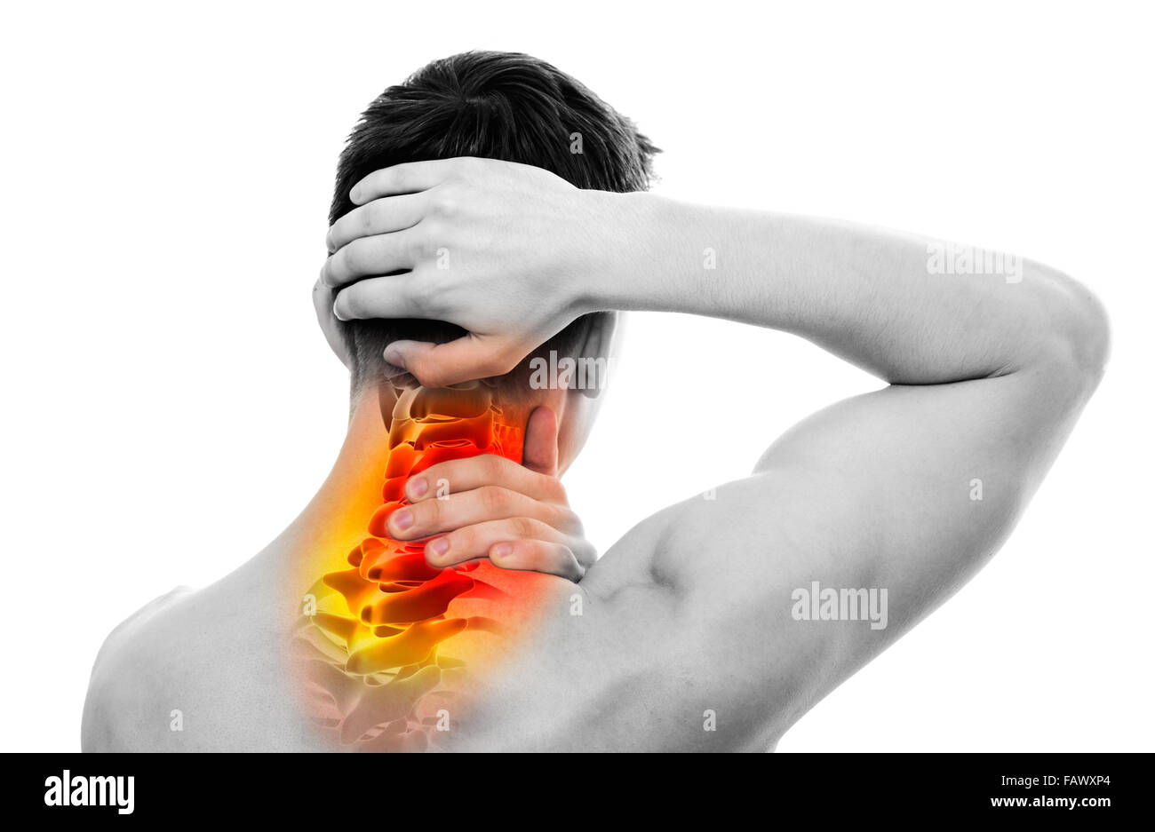 Dolore al collo - anatomia maschile sportivo tenendo la testa ed il collo - vertebre cervicali Area - isolato su bianco Foto Stock