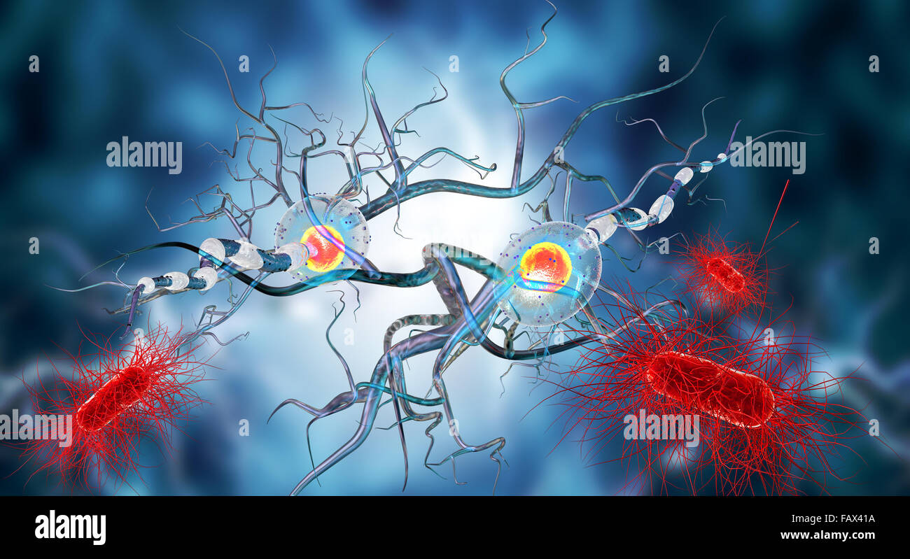 Le cellule nervose, concetto per malattie neurologiche, tumori e chirurgia cerebrale. Foto Stock