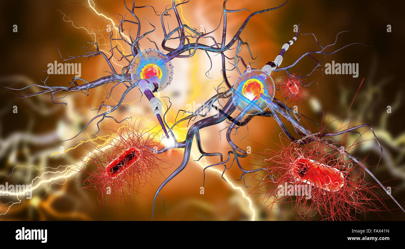 Le cellule nervose, concetto per malattie neurologiche, tumori e chirurgia cerebrale. Foto Stock