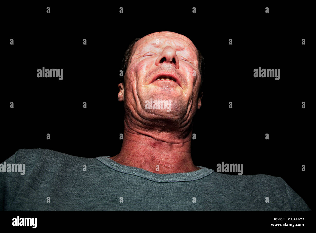 L'uomo avente un attacco d'asma. Foto Stock