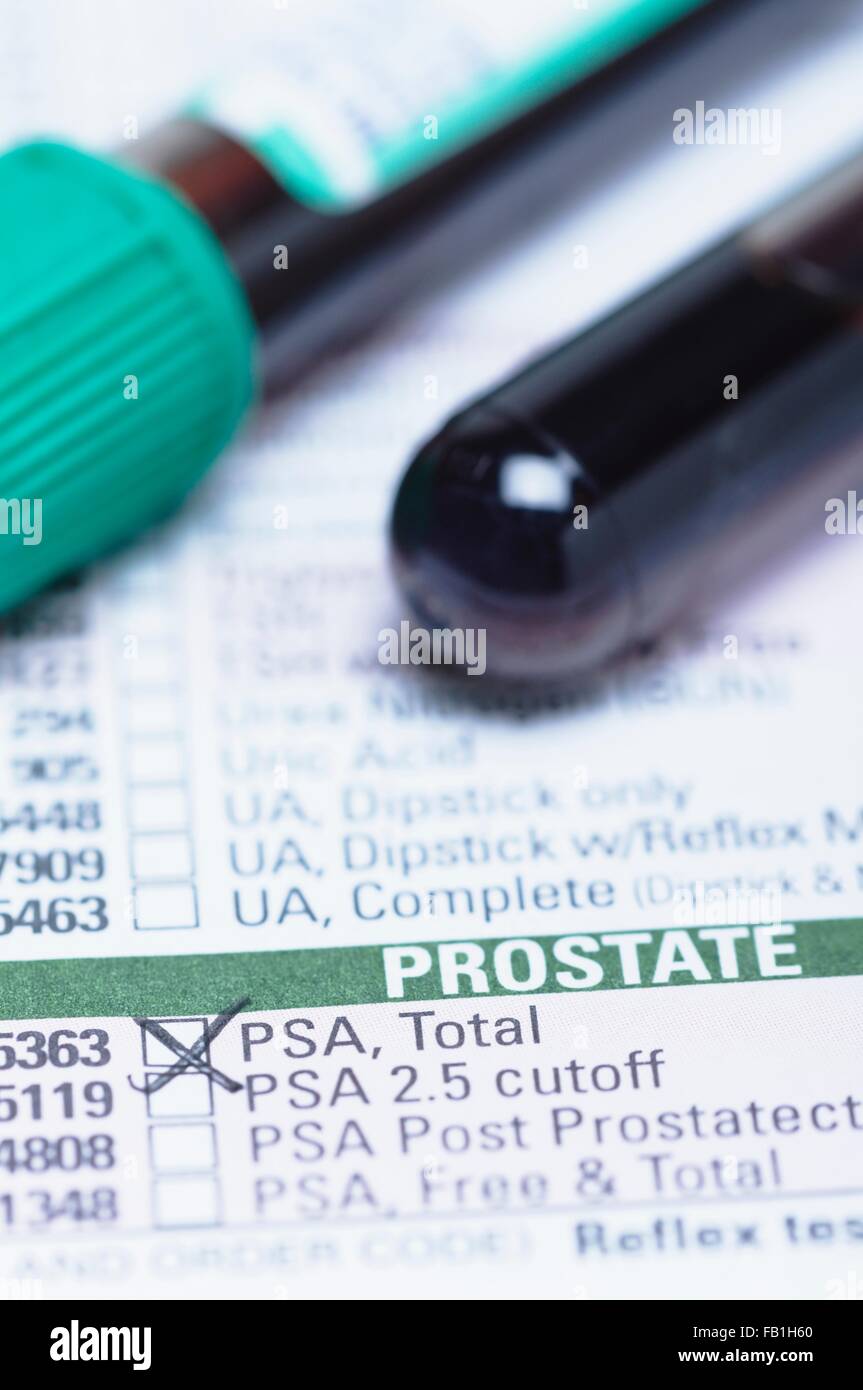 Studio shot tubo contenente il campione di sangue ematologia modulo richiesta quotazione antigene prostatico specifico test. Foto Stock