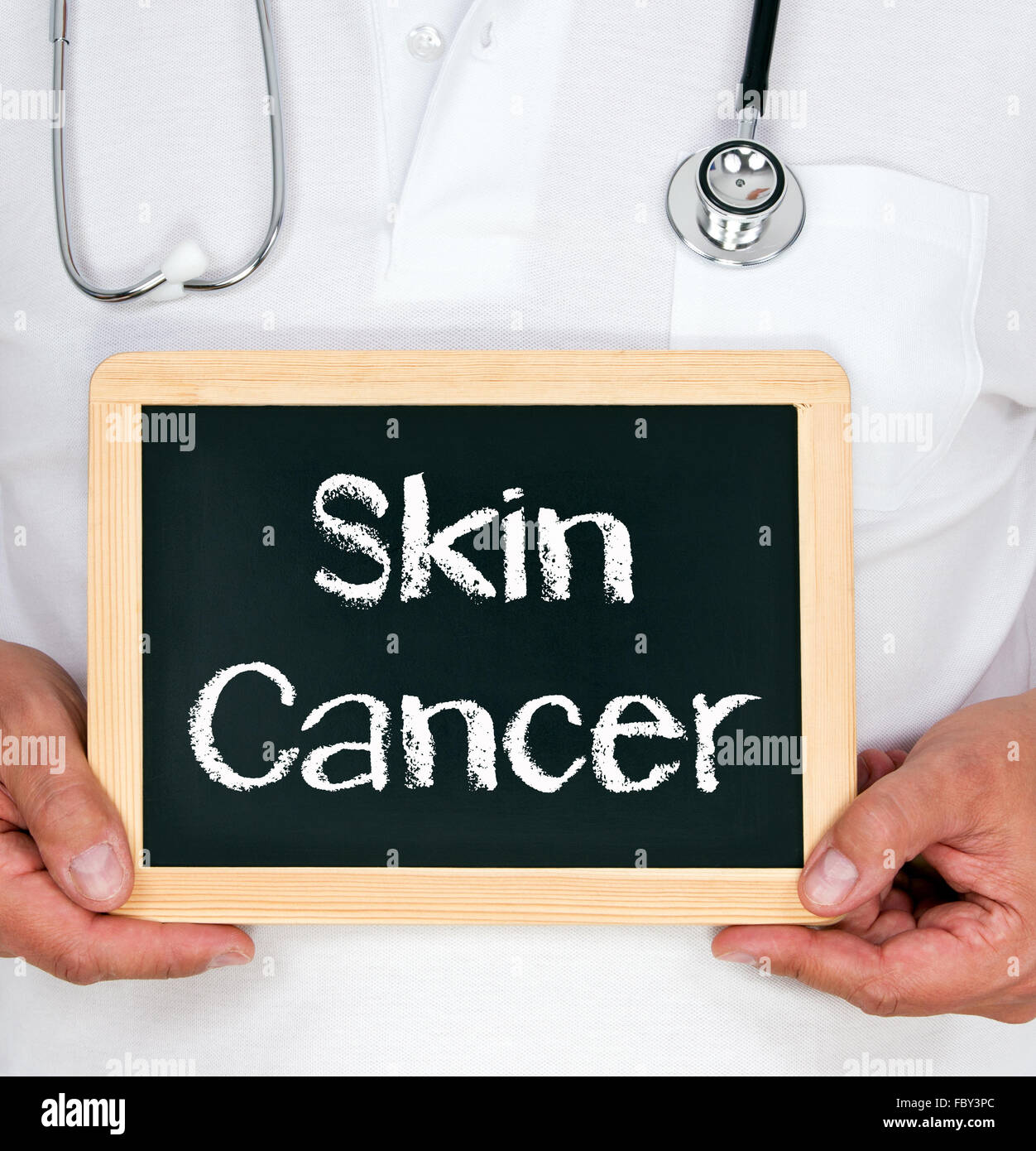 Cancro della pelle Foto Stock