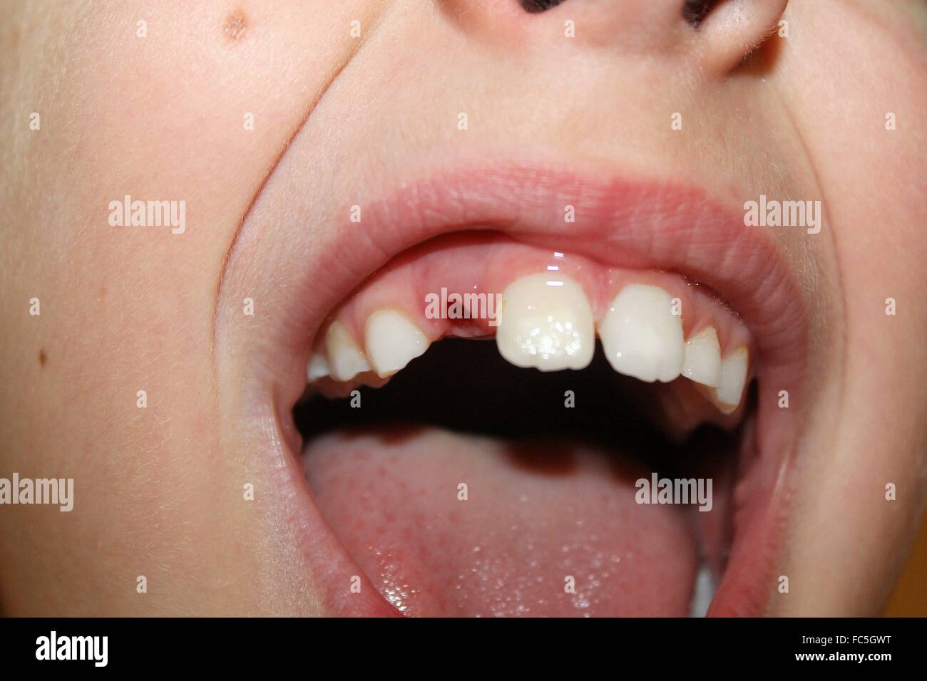 Bocca di un bambino senza un dente Foto Stock