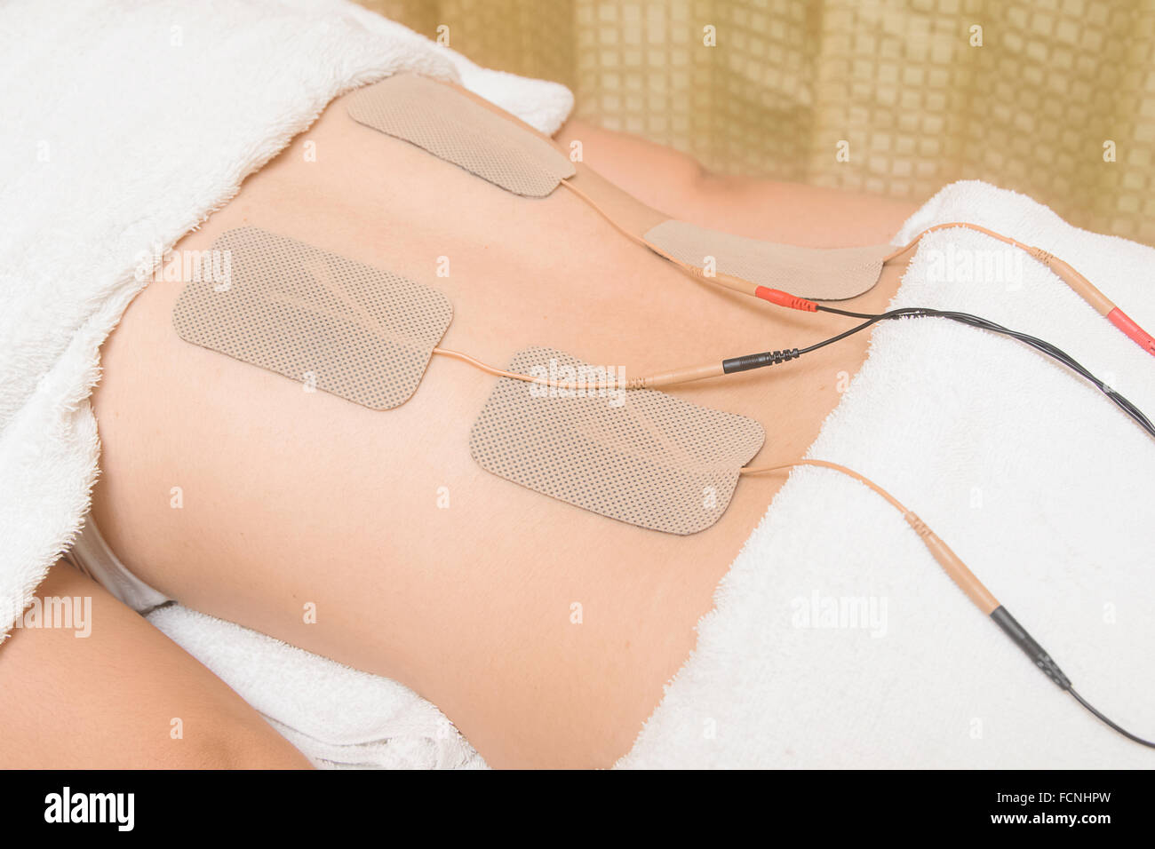 Decine di terapia, elettrodi di dispositivo rte sul muscolo posteriore Foto Stock
