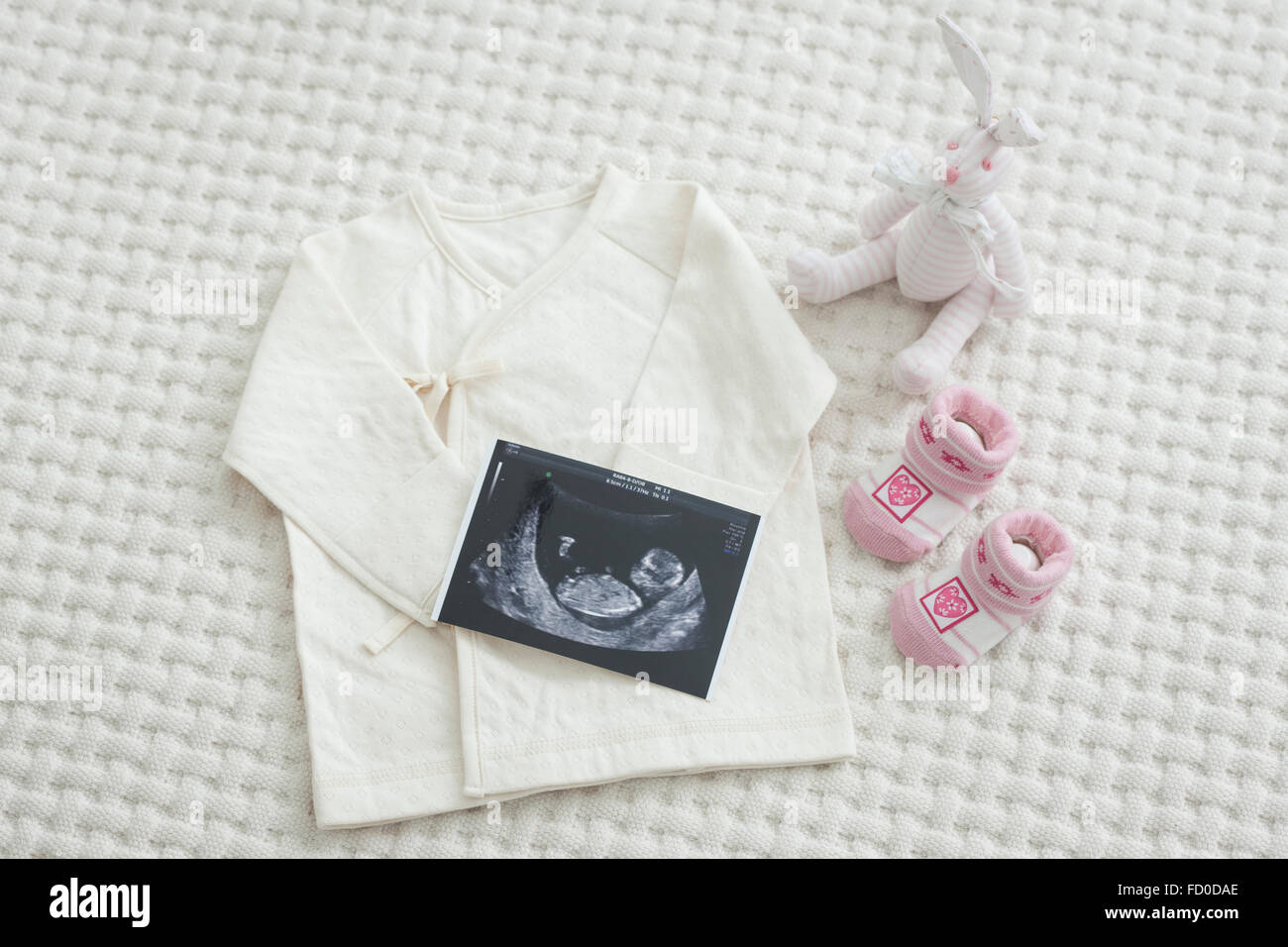Elevato angolo di sonogram di un feto e articoli per neonati Foto Stock