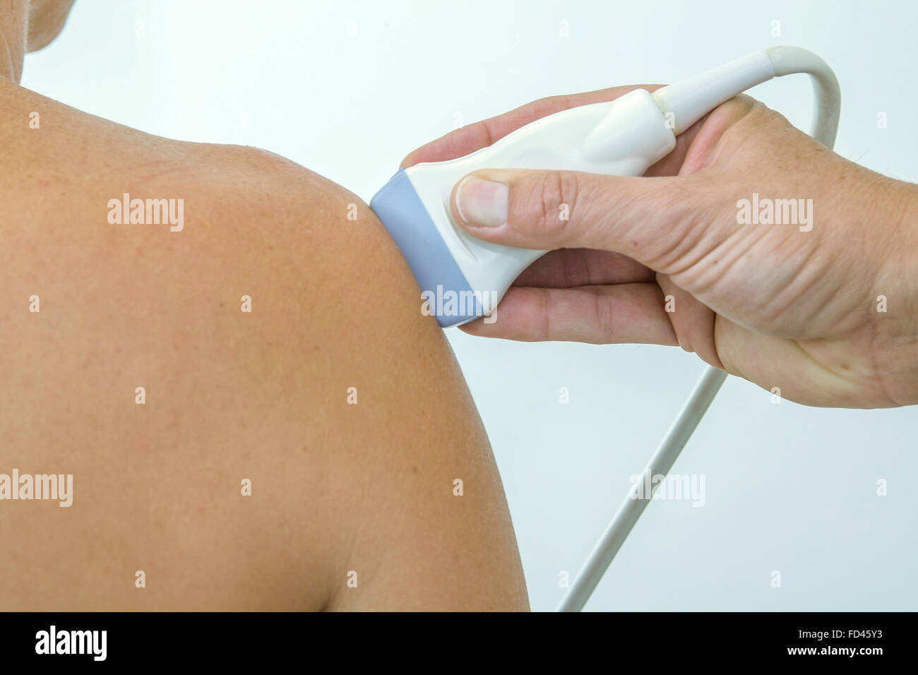 Eco ad ultrasuoni sulla spalla di una donna Foto stock - Alamy