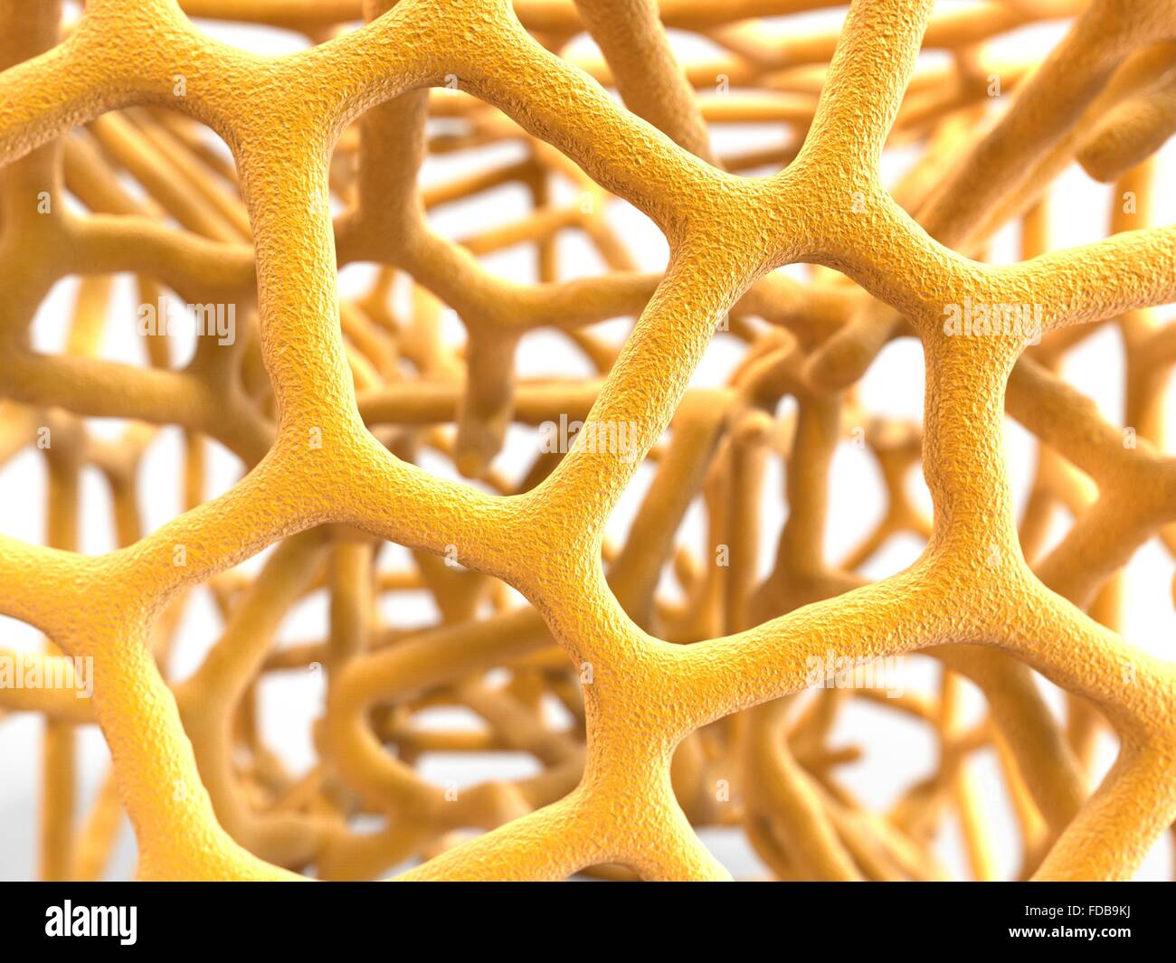L'osteoporosi. Computer grafica delle trabecole nel spugnoso spugnoso () tessuto osseo interessato da osteoporosi. Il tessuto spugnoso riempie la parte interna delle ossa e osteoporosi la sua densità diminuisce aumentando la fragilità delle ossa e la probabilità di fratture. Di solito l'osteoporosi colpisce soprattutto le donne dopo la menopausa, perché le loro ovaie non producono più gli ormoni estrogeni che aiutano a mantenere la massa ossea. Foto Stock