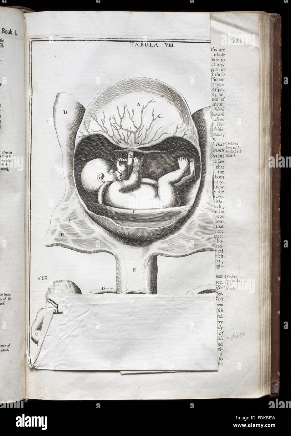 Isbrand de Diemenbeck, l'anatomia del corpo umano (Londra, 1689), a Erddig, Wrexham Foto Stock