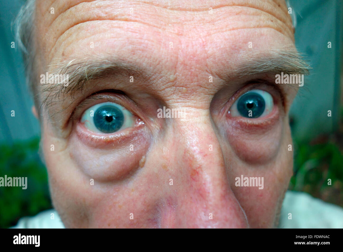 Un divertente il volto dell'uomo con occhi sporgenti Foto Stock