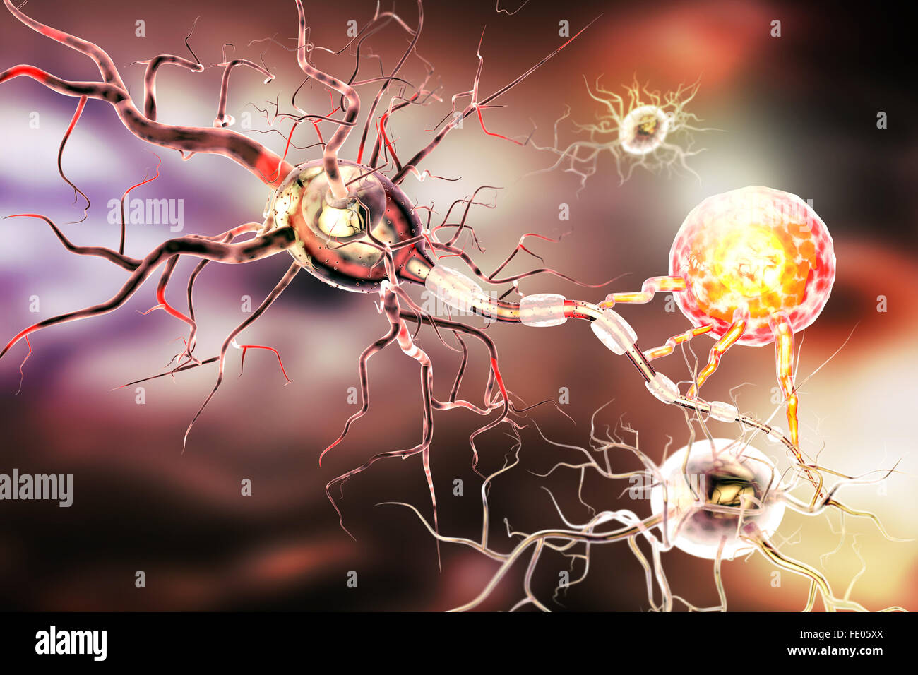 Le cellule nervose, concetto per malattie neurologiche, tumori e chirurgia cerebrale. Foto Stock