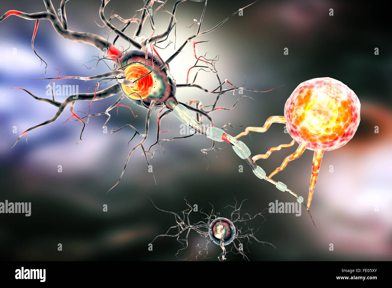Le cellule nervose, concetto per malattie neurologiche, tumori e chirurgia cerebrale. Foto Stock