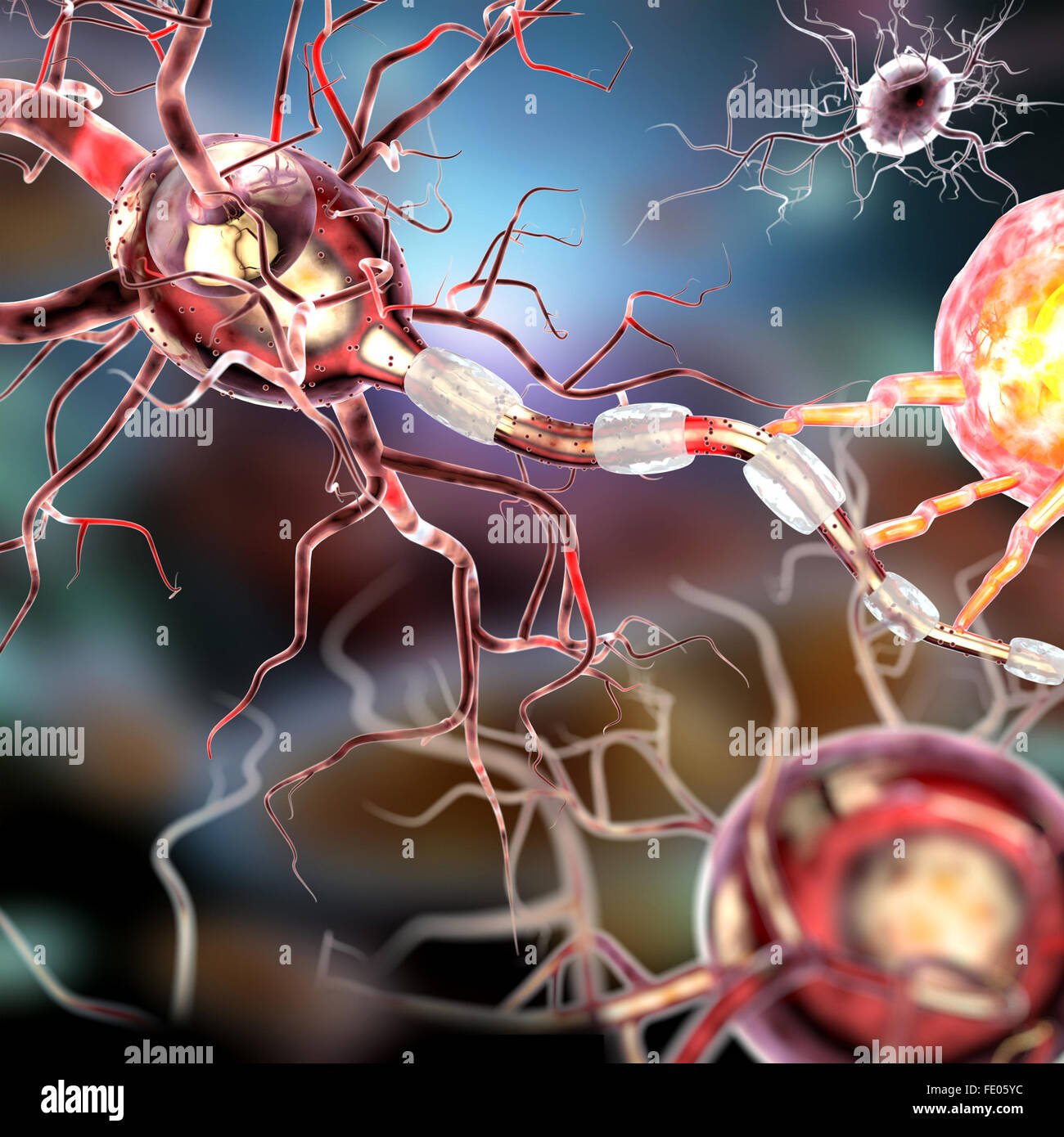Le cellule nervose, concetto per malattie neurologiche, tumori e chirurgia cerebrale. Foto Stock