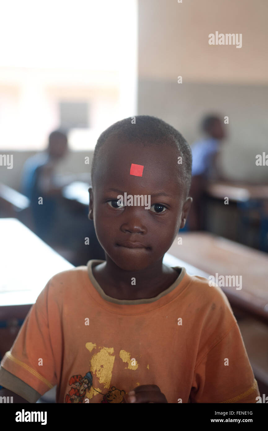 Mali, Africa - Agosto 2009 - Closeup ritratto di un africano nero scuola primaria studente con un vaccino stick sulla sua parte anteriore Foto Stock