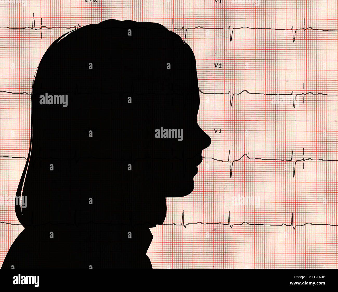 Generata da computer testa di donna su sfondo EKG Foto Stock