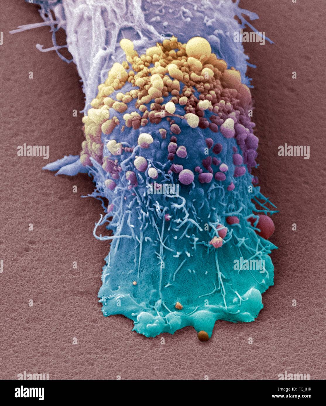 Il cancro della pelle cella, colorata di microfotografia electron scansione (SEM). Coltura di cellule di melanoma che mostra le numerose blebs e microvilli Foto Stock