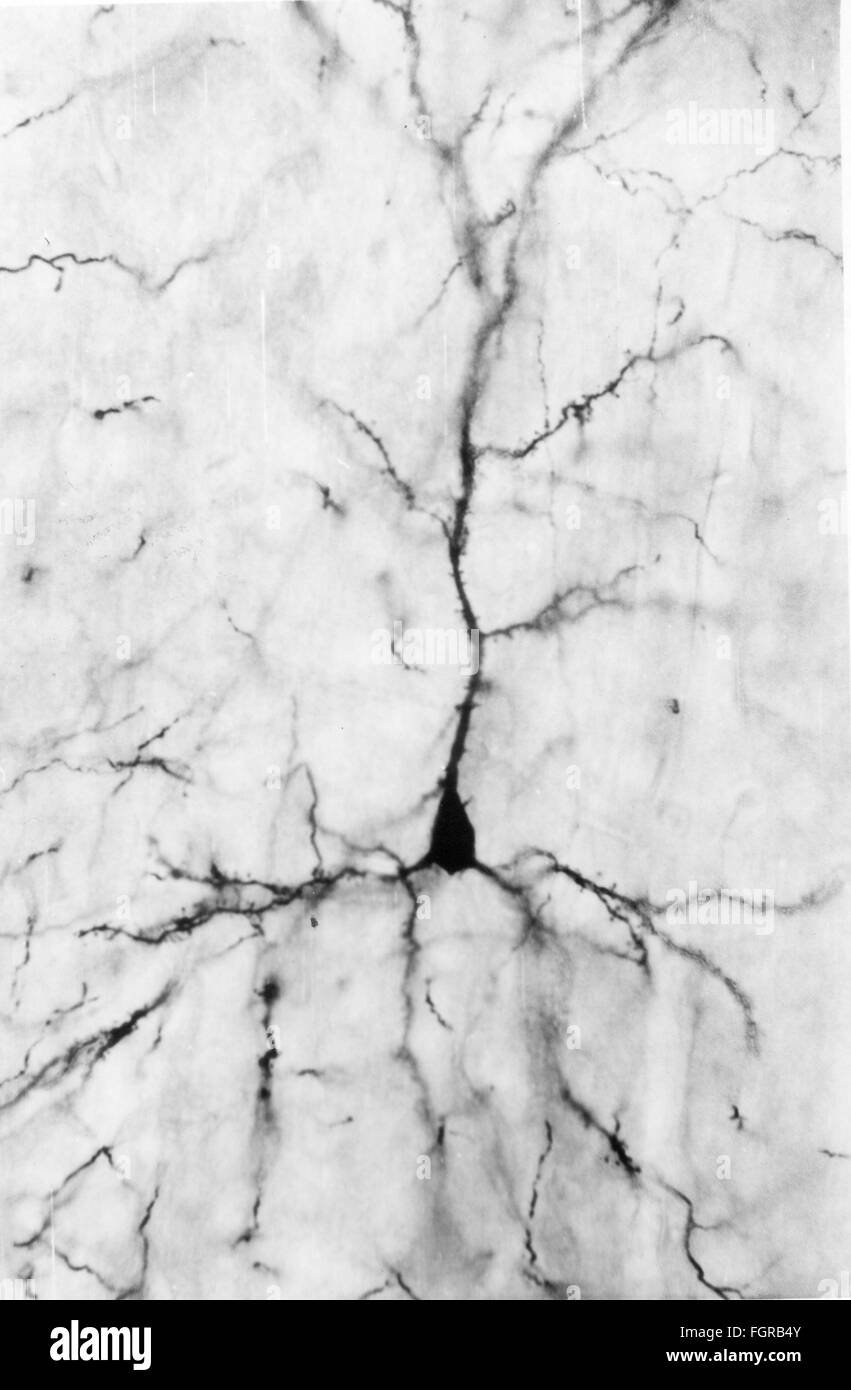 Medicina, anatomia, cerebrico / cranio, cortici del cerebrio umano, cellule piramidali, 20 ° secolo, 20 ° secolo, microscopia, cellula nervosa, cellule nervose, neurale, neuritico, percorso nervoso, tratto nervoso, vie nervose, tratti nervosi, corteccia cerebrale, cellule piramidali, medicina, farmaci, storico, diritti aggiuntivi-clearance-non disponibili Foto Stock