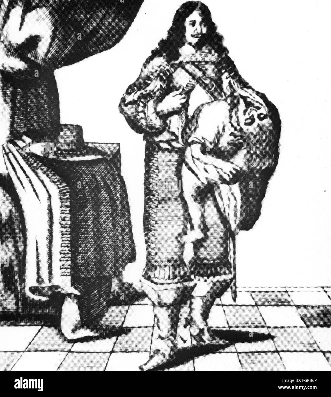 Medicina, anomalia, siamesi, Lazzaro e Joannes Baptista Colloredo (1617 - dopo il 1646) da genova, incisione su rame, xvii secolo XVII secolo, grafica, grafica, l'Italia, a piena lunghezza, in piedi, malformazione, malformazioni congenite, deformità, deformità, medicina, medicinali, mostro, anomalie, twin, gemelli, Genova, Genova, storico, storico, Uomo, uomini, maschio, persone, artista del diritto d'autore non deve essere cancellata Foto Stock
