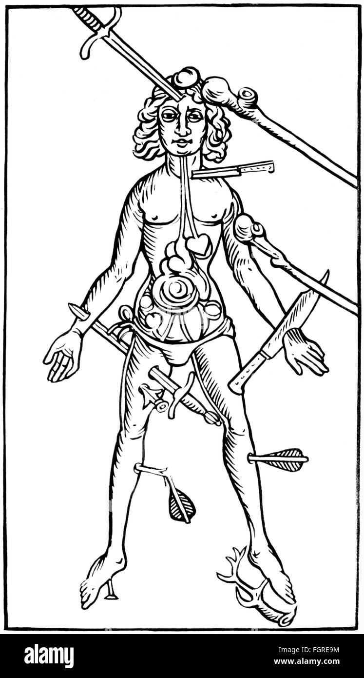 Medicina, anatomia, ferito, taglio di legno, su: Hieronymus Brunschwig (circa 1450 - circa 1512), 'Das Buch der Cirurgia', stampa: Johann Grüninger, Strasburgo, 1500, diritti-aggiuntivi-clearences-not available Foto Stock