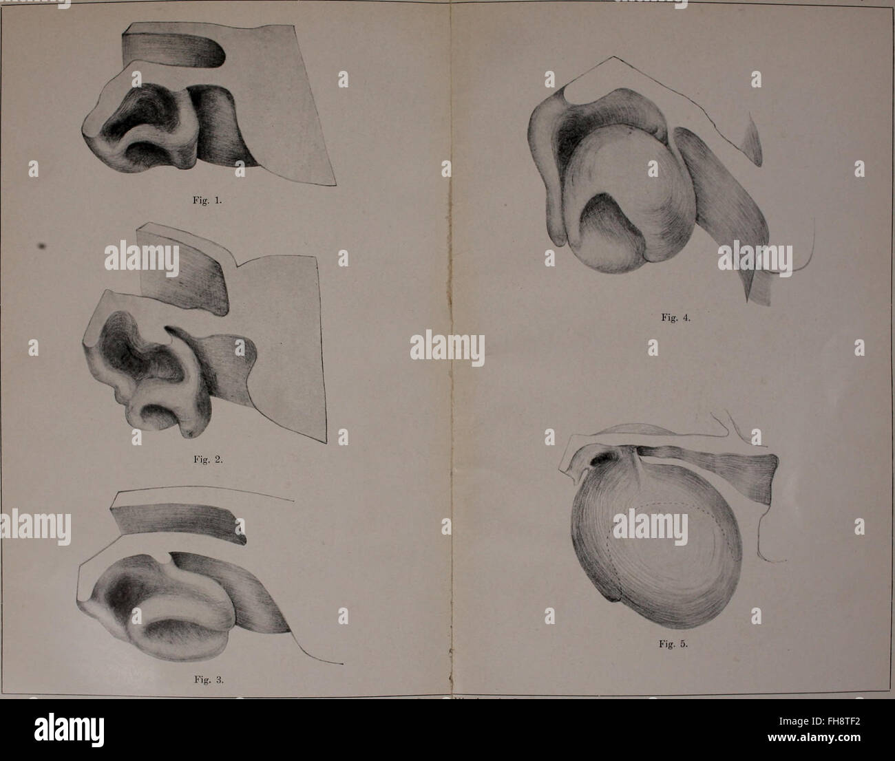 Uno studio dettagliato sull'ontogenia (sviluppo) dei denti primati, esplorando modelli di crescita, strutture anatomiche e implicazioni evolutive. Foto Stock