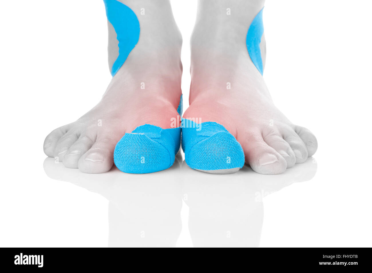 Kinesio nastro sul piede femminile isolato su sfondo bianco. Il dolore cronico, medicina alternativa. Riabilitazione e Fisioterapia. Foto Stock