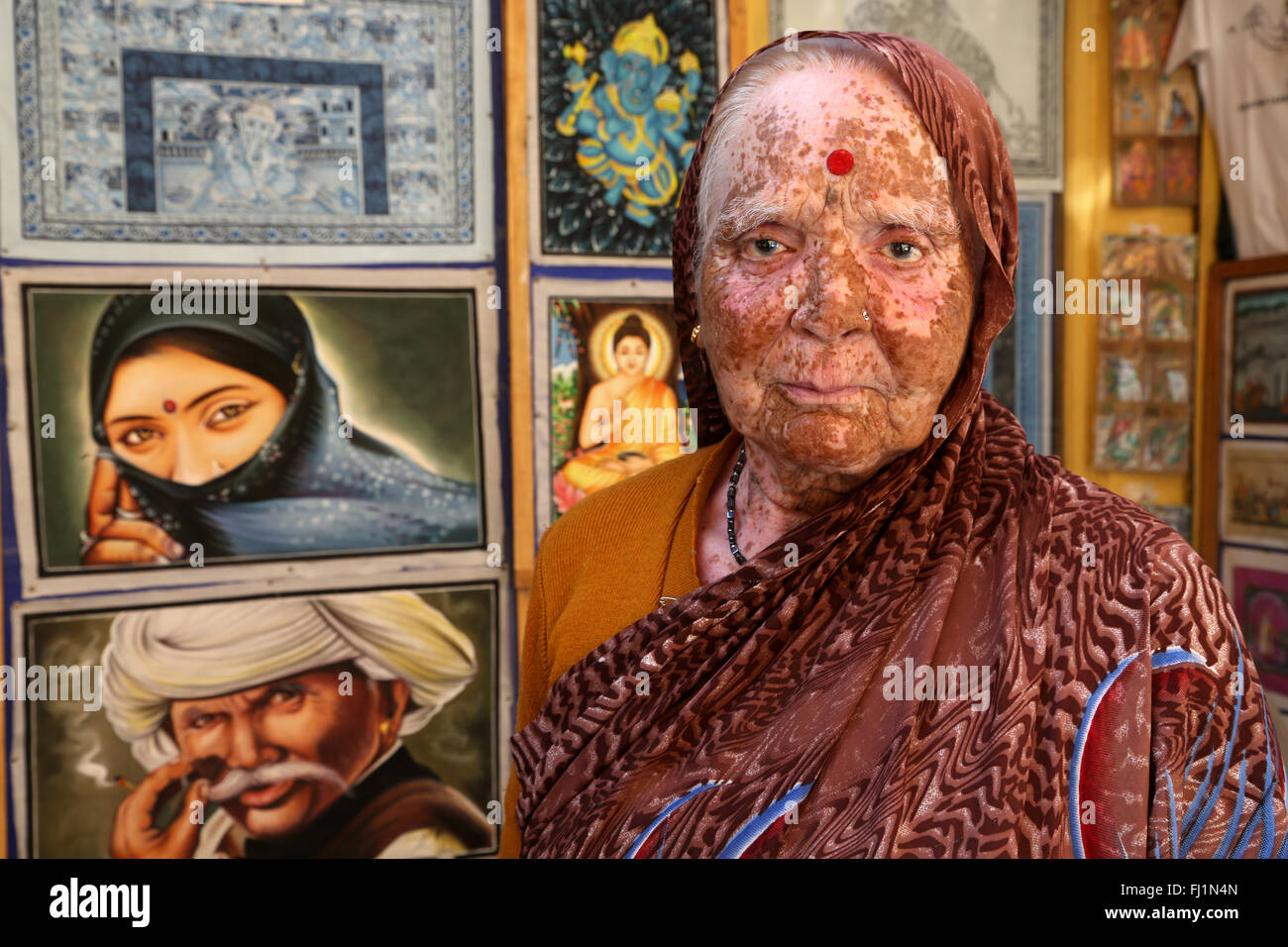 Donna con la malattia della pelle chiamato 'vitiligine' in Jaisalmer , India Foto Stock