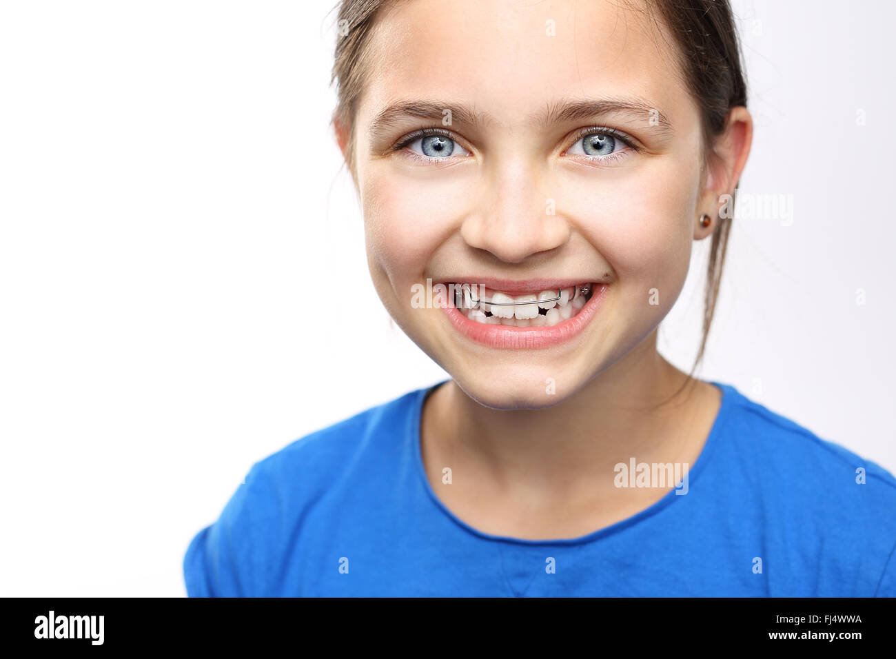 Bambino con apparecchio ortodontico.. Sana, bel sorriso, il bambino dal dentista. Ortodonzia, uno splendido sorriso. Foto Stock