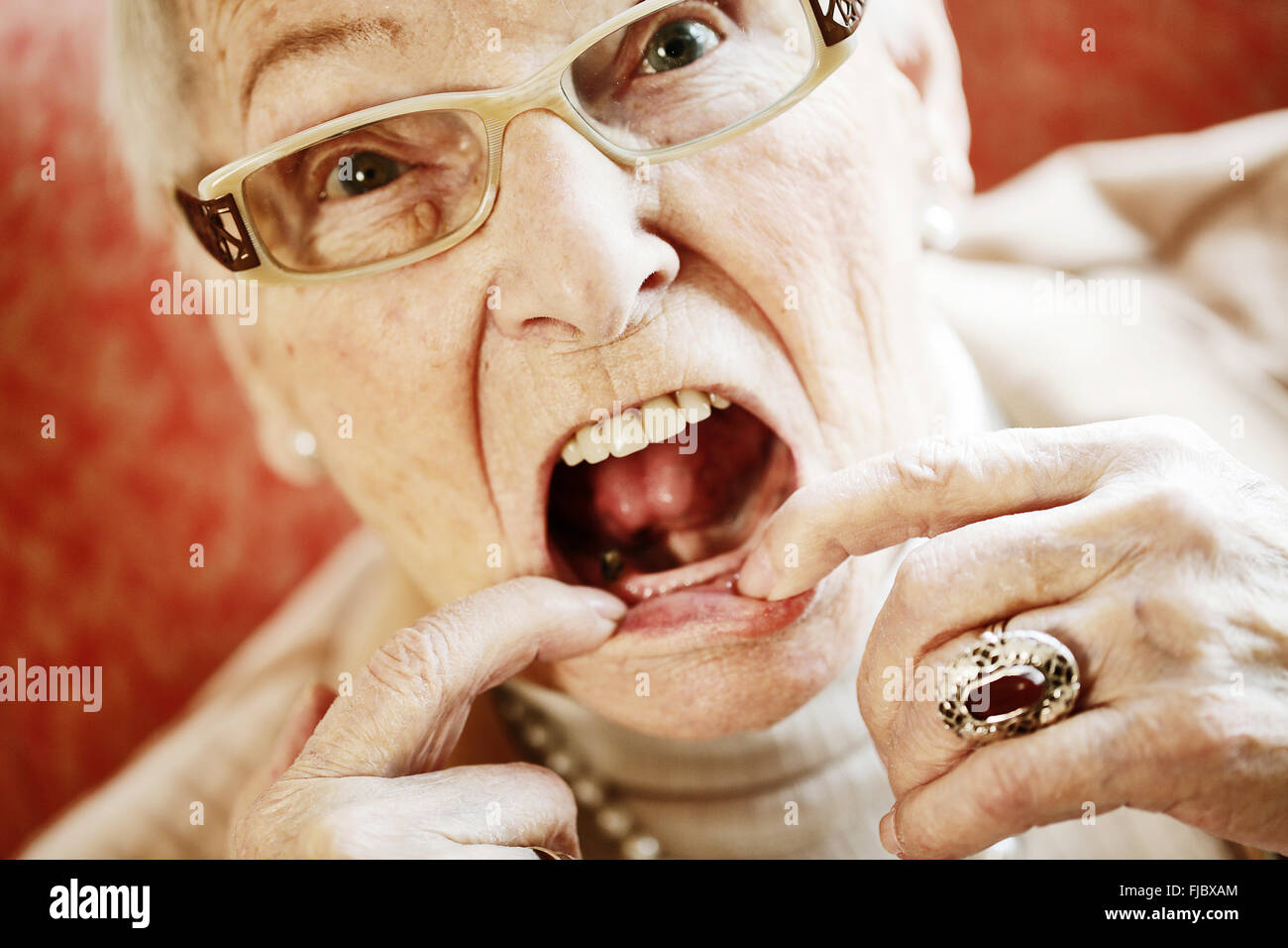 Senior affetti da demenza che mostra la sua bocca con denti mancanti, Nord Reno-Westfalia, Germania Foto Stock