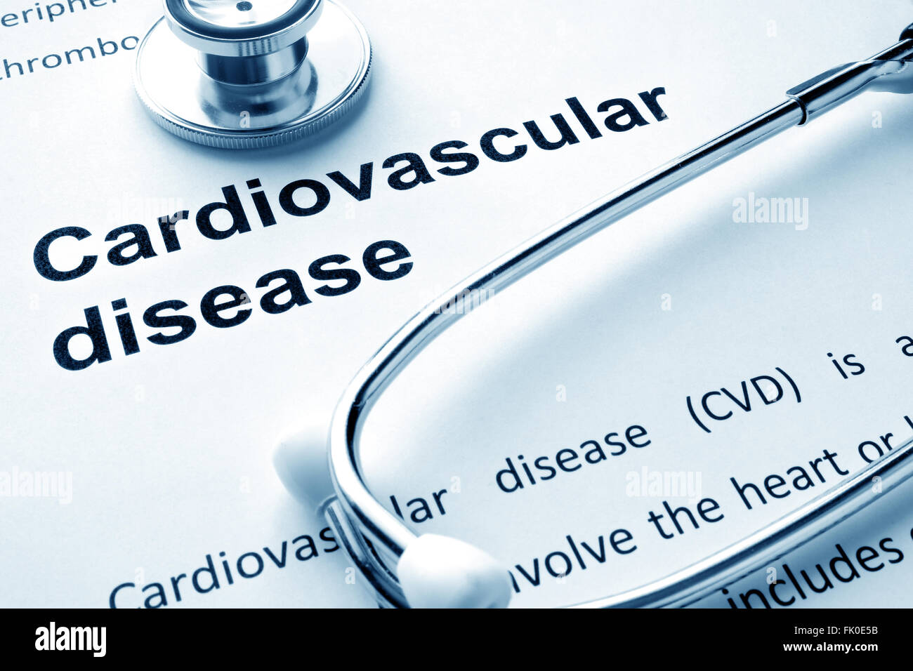 Carta con parole di malattie cardiovascolari e di uno stetoscopio. Foto Stock