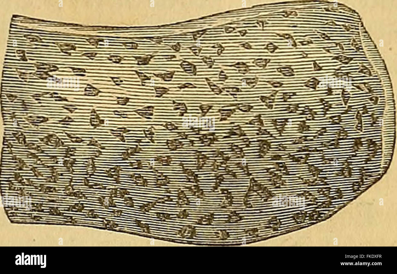 "Elementi di anatomia patologica" (1843) Foto Stock