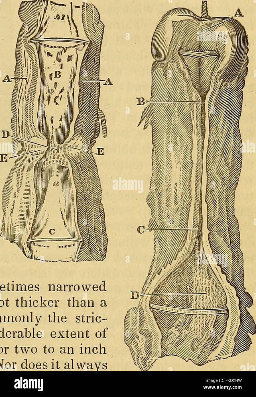 "Elementi di anatomia patologica" (1843) Foto Stock