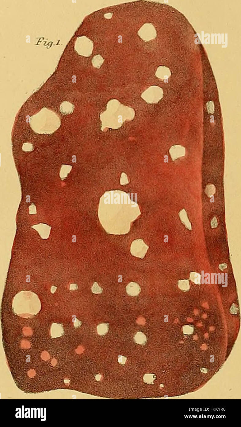 "Elementi di anatomia patologica" (1843) Foto Stock