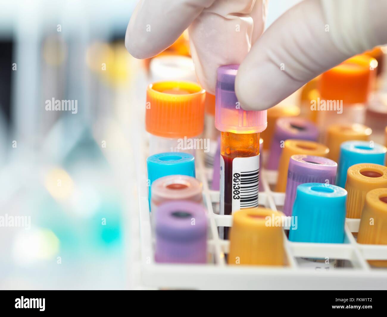 Tecnico di laboratorio di preparazione di campioni di sangue per il test medici in laboratorio Foto Stock