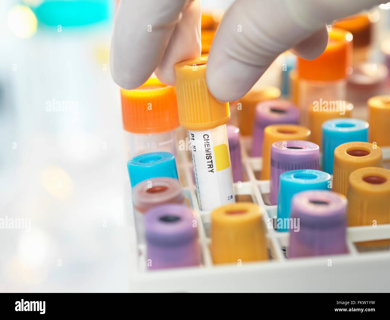 Tecnico di laboratorio di preparazione chimica umana campione per analisi cliniche in laboratorio Foto Stock