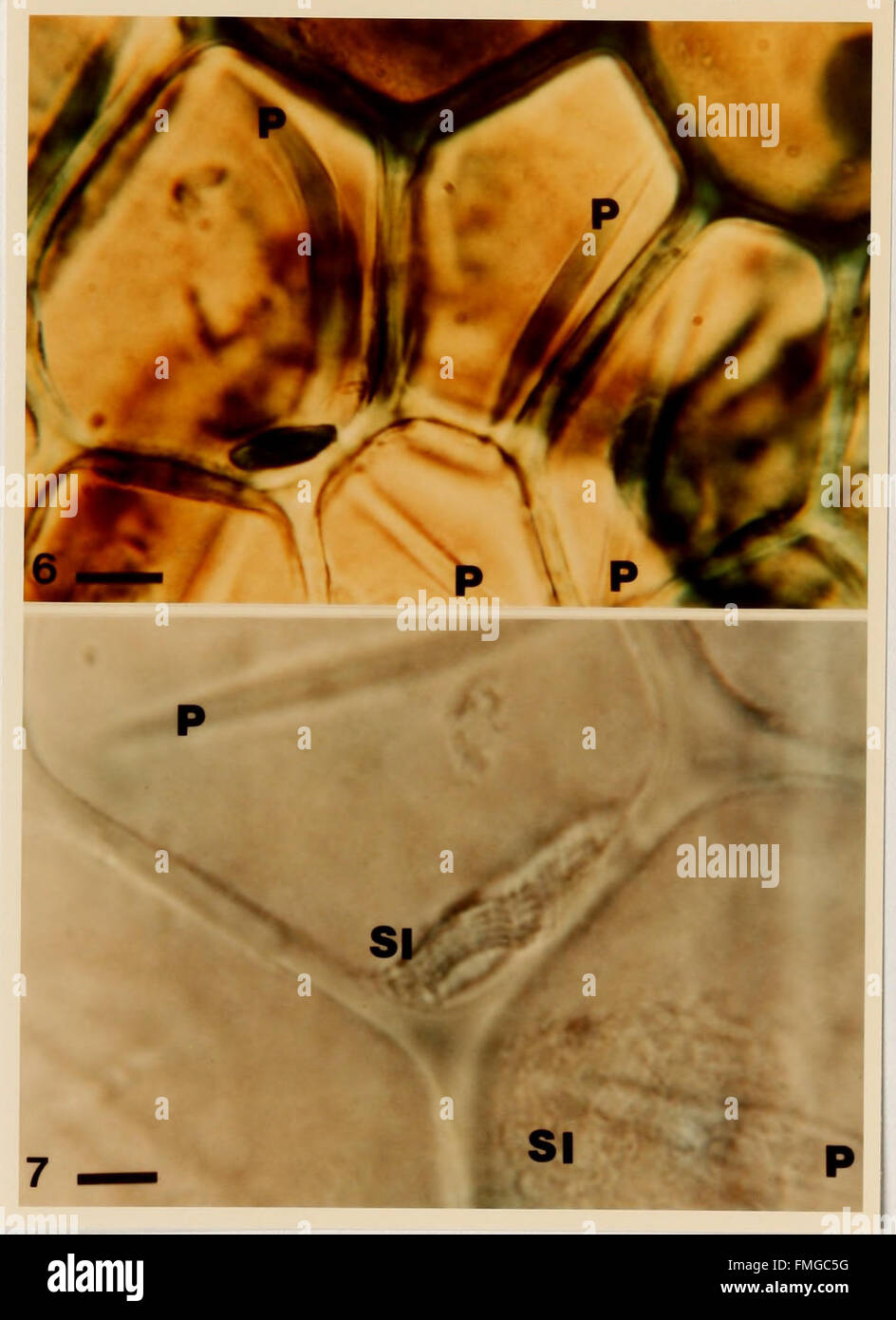 Metodi citologici per il rilevamento, l'identificazione e la caratterizzazione del virus di orchidee e i loro corpi di inclusione (1985) Foto Stock