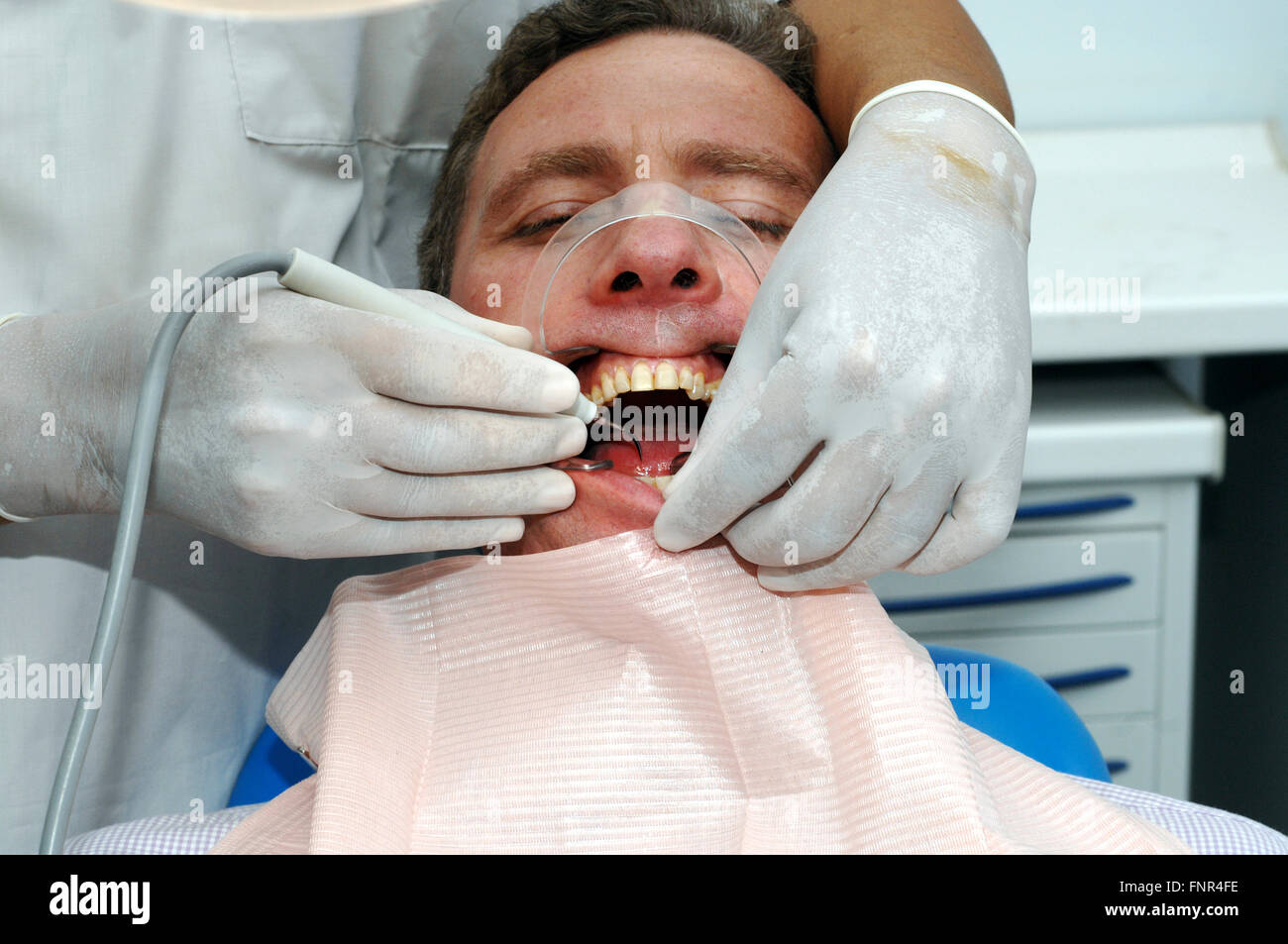 Un dentista rimozione della placca e del tartaro da un uomo di denti per evitare di cavità e altri problemi peridontal Foto Stock