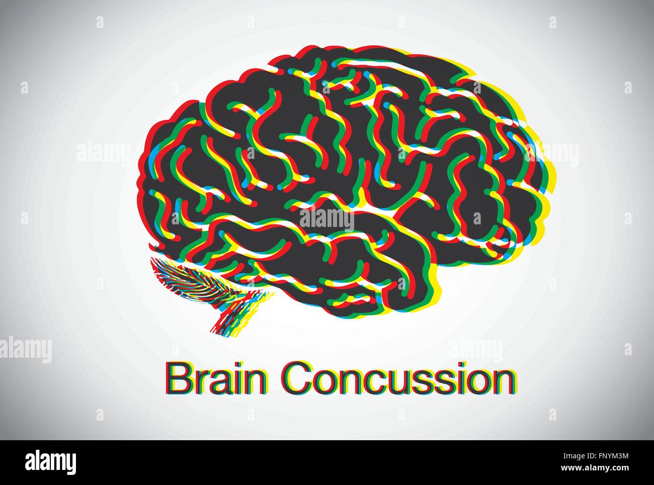 Commozione cerebrale Illustrazione Vettoriale