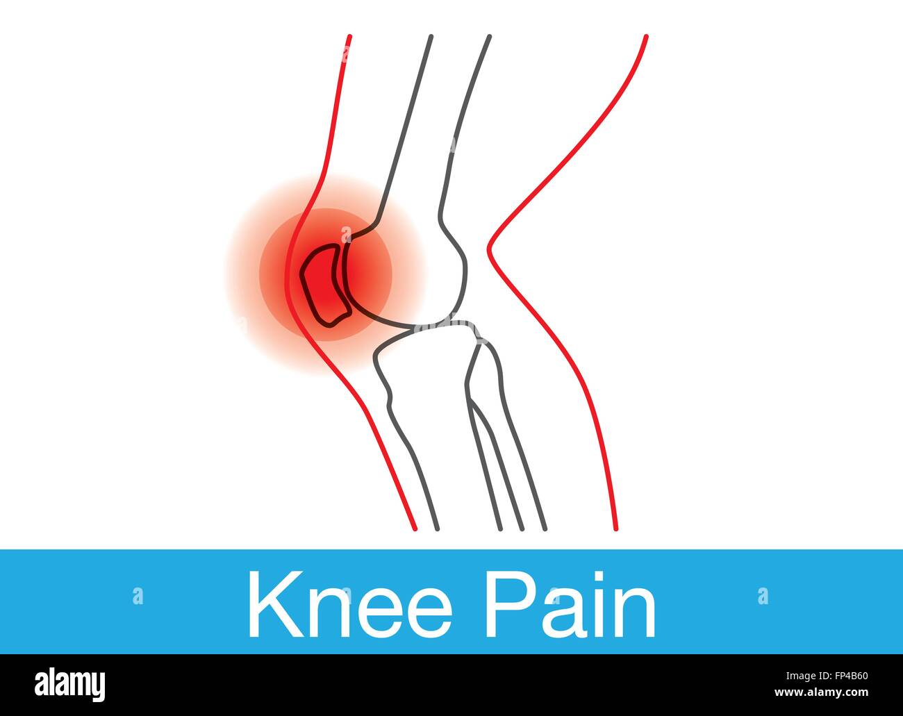 Il dolore al ginocchio contorno Illustrazione Vettoriale