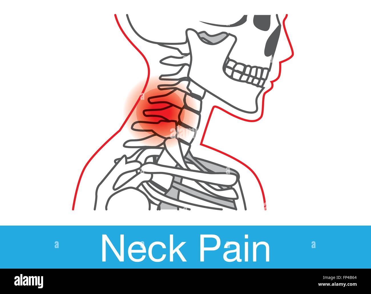 Dolore al collo contorno Illustrazione Vettoriale