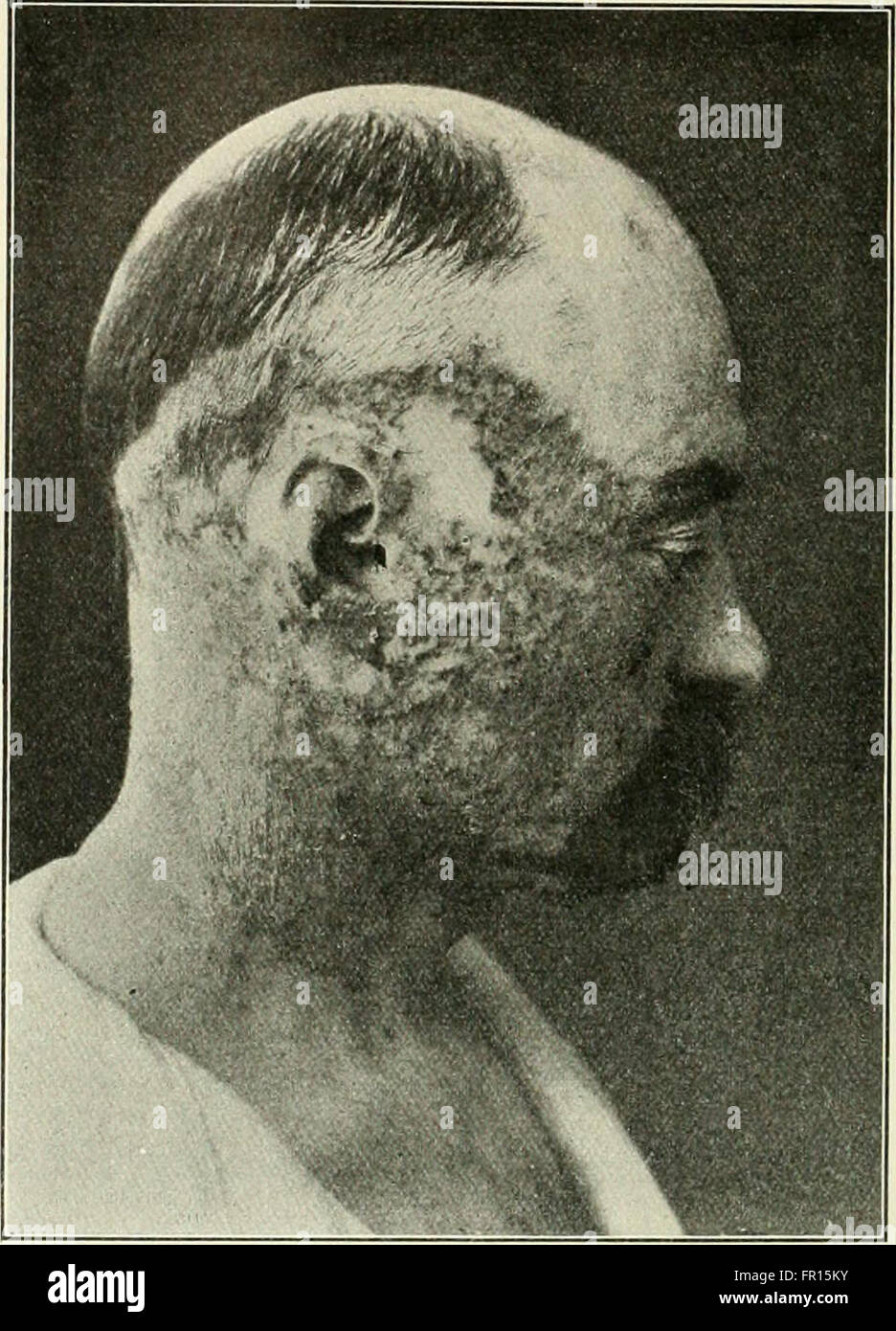 Questo manuale di riferimento del 1900 sulle scienze mediche fornisce una panoramica completa delle conoscenze mediche del tempo, coprendo una serie di argomenti scientifici e pratici relativi alla sanità e alla medicina. Foto Stock