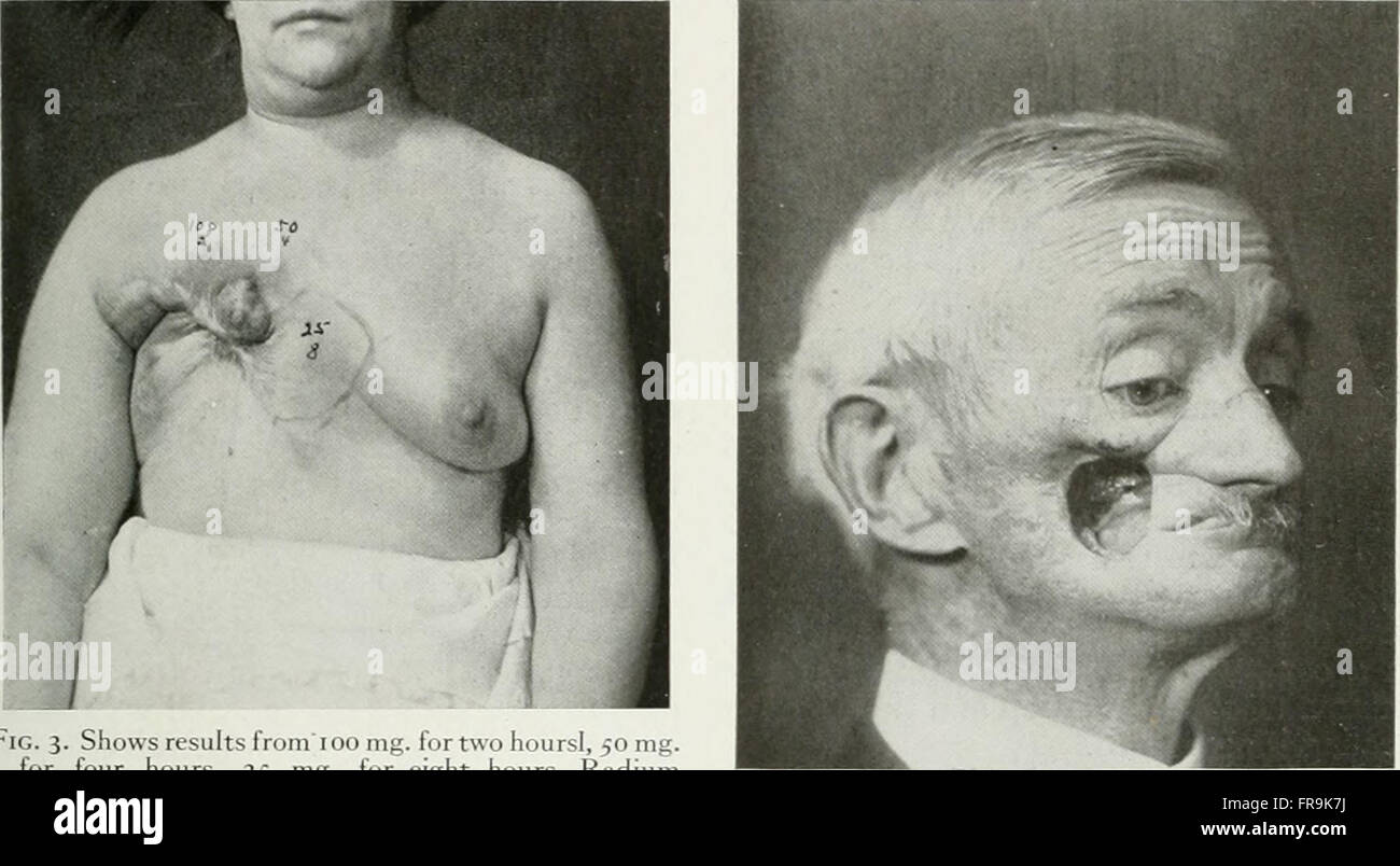 American journal of roentgenology, radium terapia e medicina nucleare (1906) Foto Stock