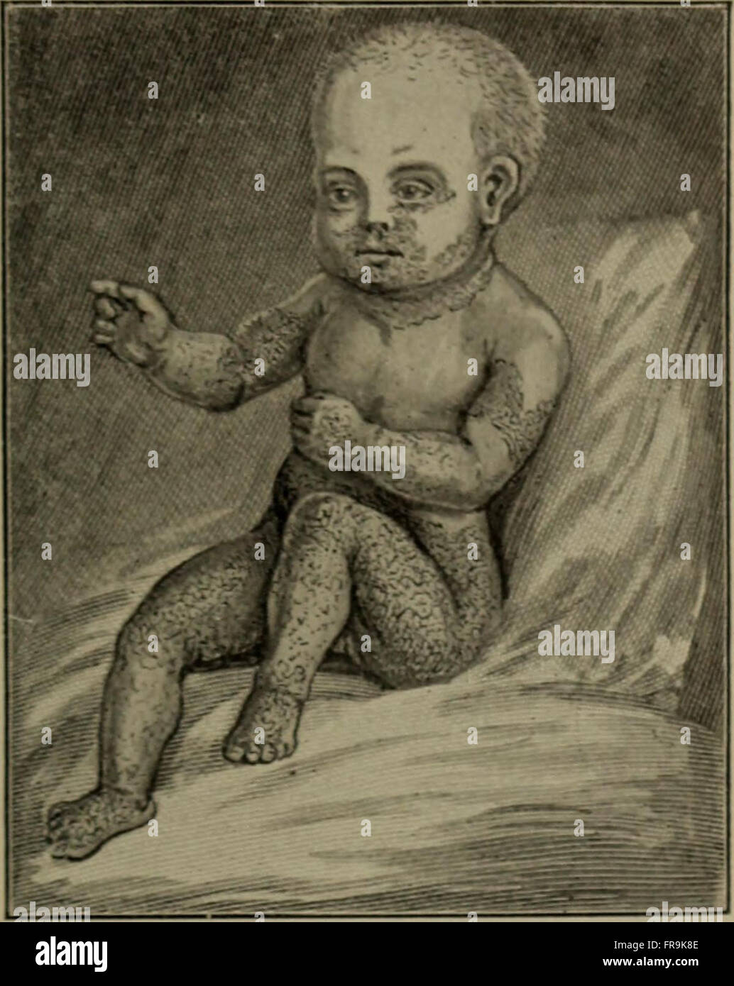 Malattie mediche dell'infanzia e della fanciullezza (1900) Foto Stock
