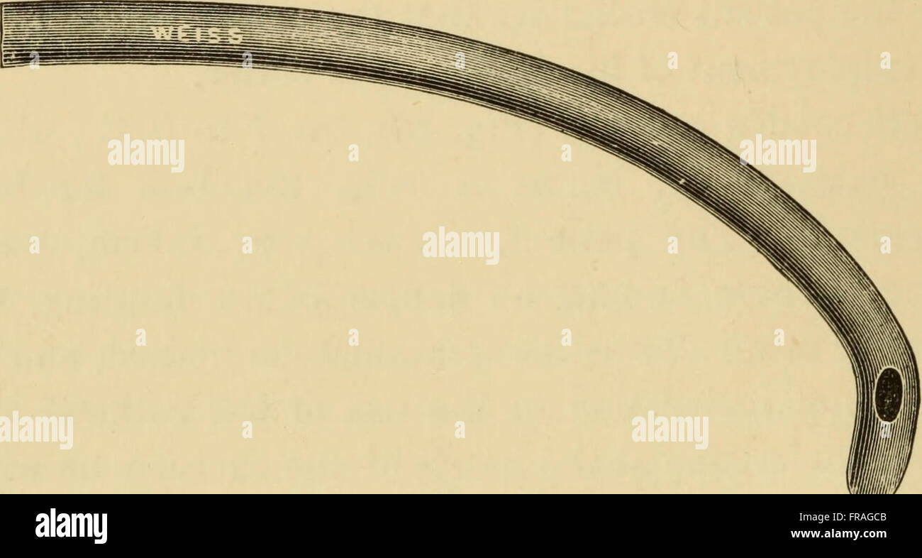 Questo testo medico del 1901 fornisce informazioni cliniche sulle cause, la diagnosi e i trattamenti della stenosi uretrale e dell'allargamento della prostata, questioni chiave nell'urologia all'inizio del XX secolo. Foto Stock