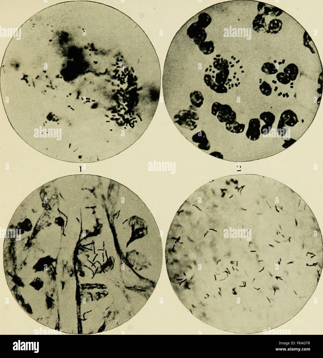 Il presente manuale del 1895 fornisce linee guida dettagliate sulle pratiche moderne dell'asepsi chirurgica, concentrandosi su tecniche e procedure per garantire condizioni sterili durante gli interventi chirurgici per prevenire le infezioni. Foto Stock